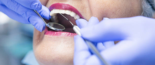Best Root Canal Emergency Dentist  in Lakin, KS