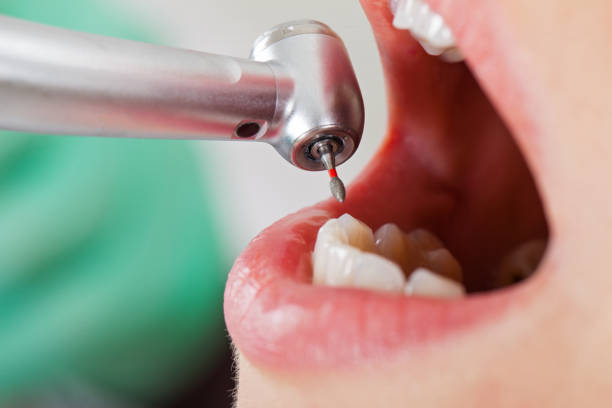 Best Knocked-Out Tooth Emergency  in Lakin, KS